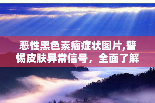 恶性黑色素瘤症状图片,警惕皮肤异常信号,全面了解恶性黑色素瘤的典型症状 恶性黑色素瘤症状图片,警惕皮肤异常信号,全面了解恶性黑色素瘤的典型症状